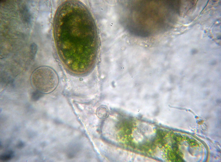 Alghe 3: Spirogyra sp